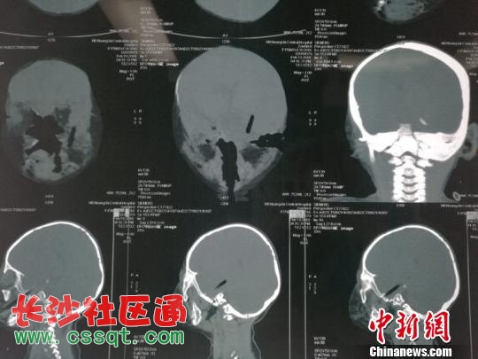 @U(xin)ͯ߅߅ˤӲB(ni)׈D